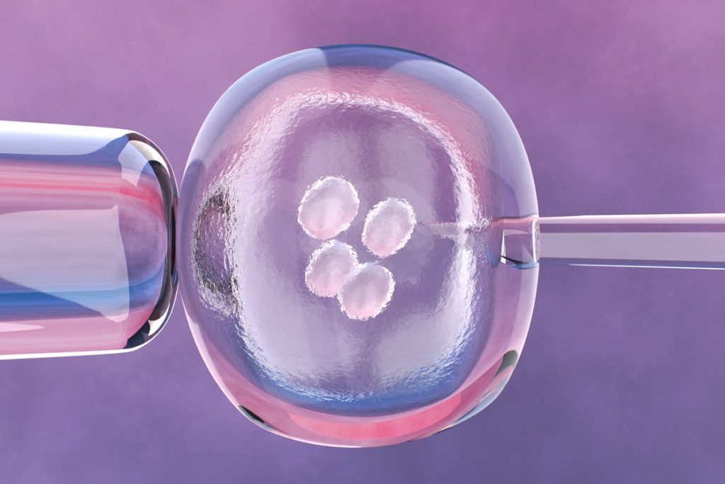 IVF (In Vitro Fertilization) clinics in india