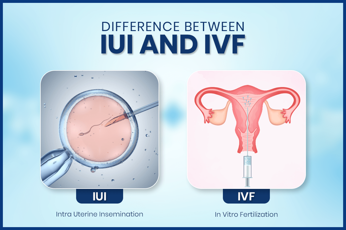 Basics of IUI and IVF
