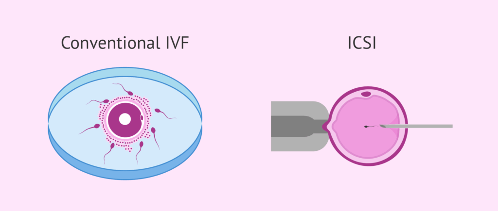 Science Behind In Vitro Fertilization