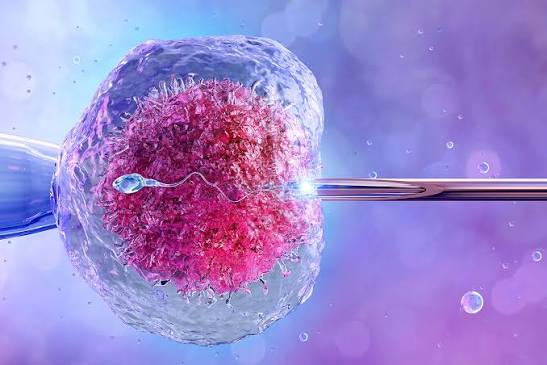 Frozen Embryo Transfer