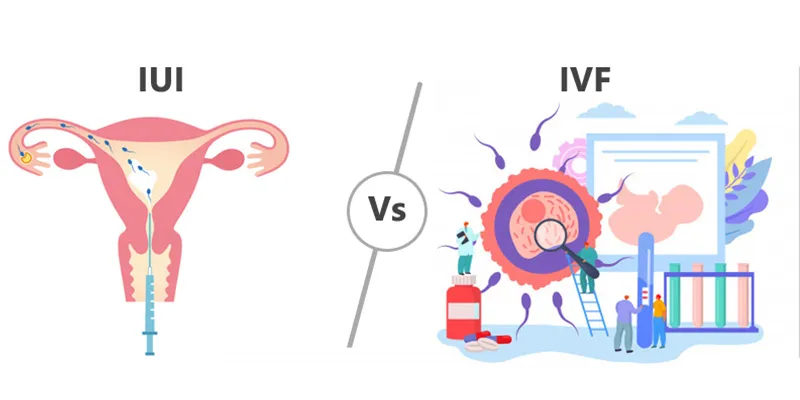 IVF vs IUI
