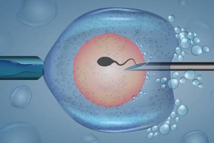 Understanding IVF Treatment